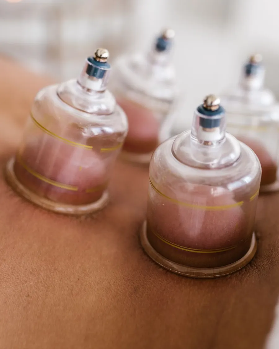 Hijama